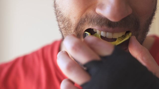 The Science Behind Mouth Guards: How They Work to Prevent Injuries