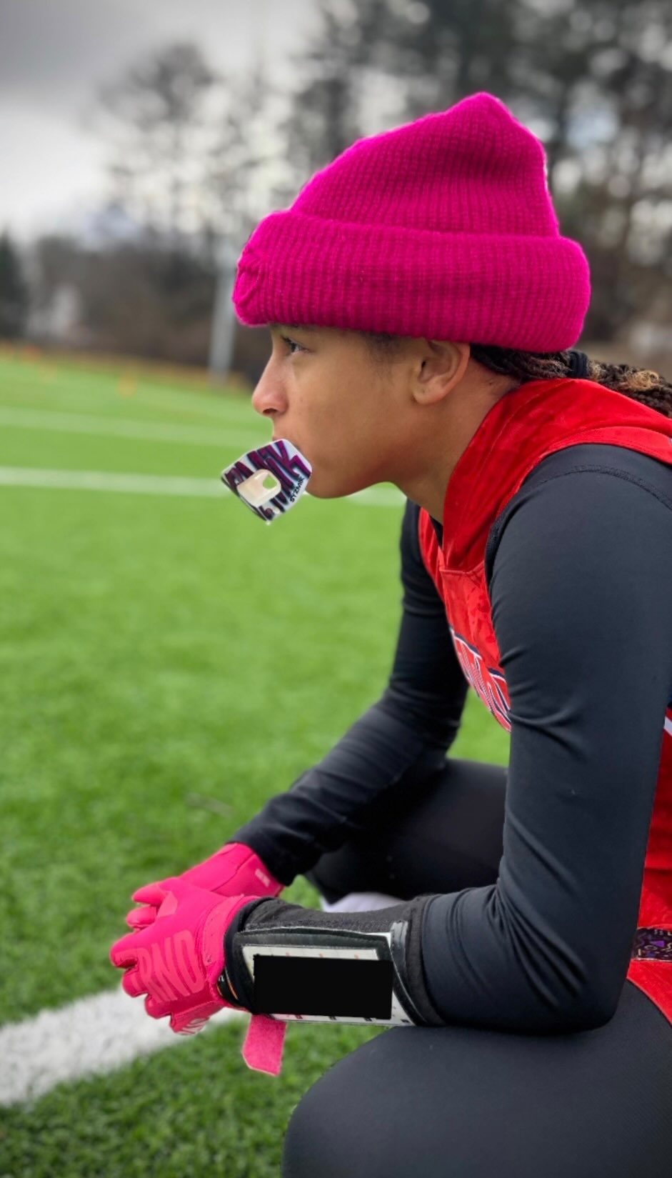 The Crucial Role of Safe and Latex-Free, BPA-Free Materials in Mouthguards and Lip Guards for Athletes